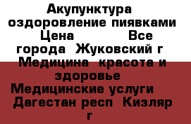 Акупунктура, оздоровление пиявками › Цена ­ 3 000 - Все города, Жуковский г. Медицина, красота и здоровье » Медицинские услуги   . Дагестан респ.,Кизляр г.